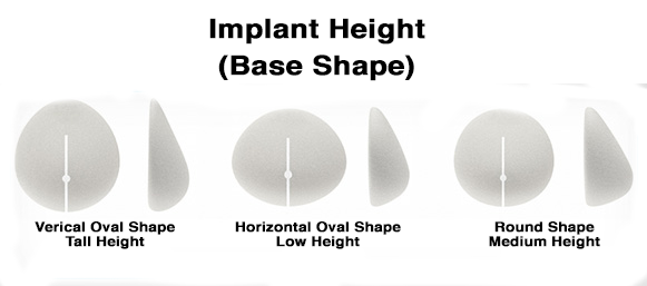 implant height base shapes 